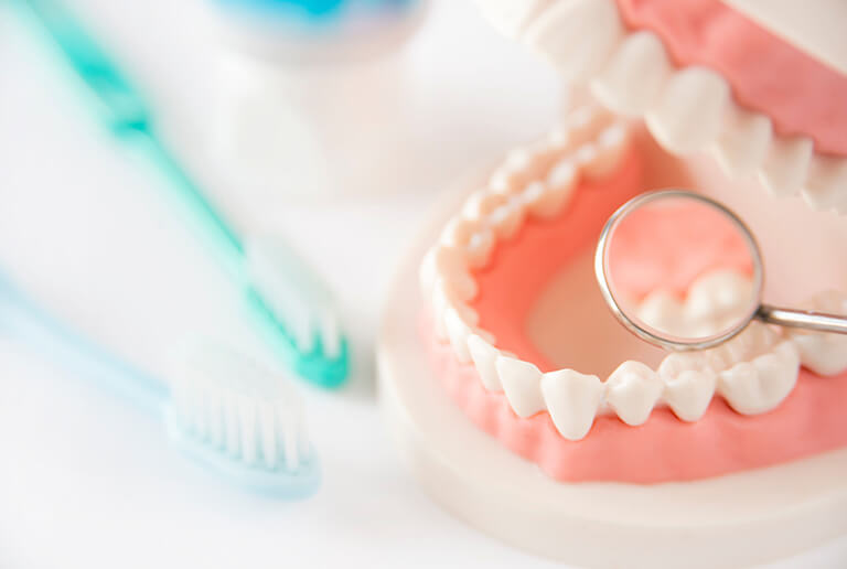 『定期管理型』予防歯科の実践