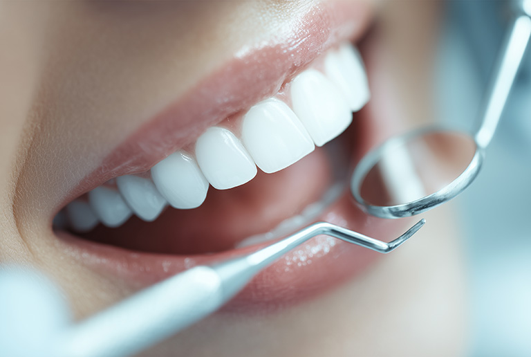 虫歯の定期的評価