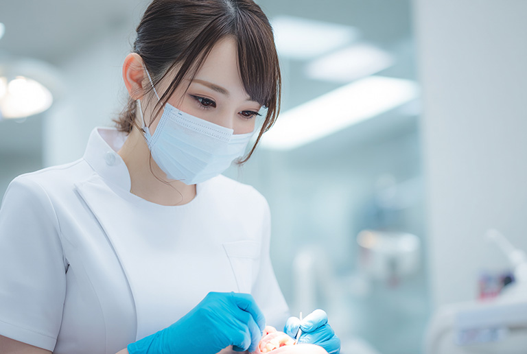 歯科衛生士によるプロフェッショナルケア