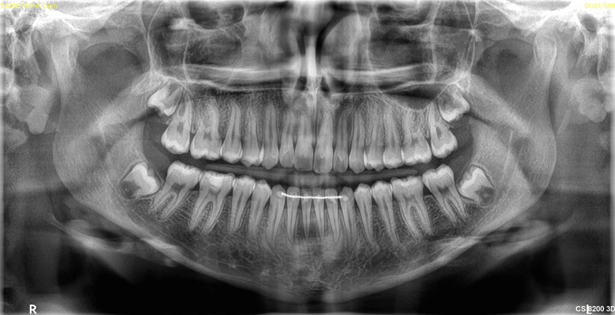くっきりとしたレントゲン画像