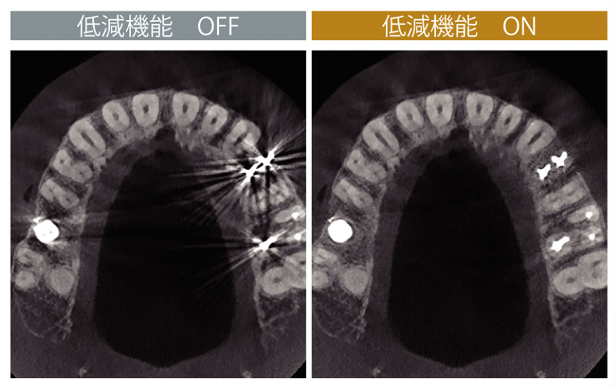 レントゲン画像