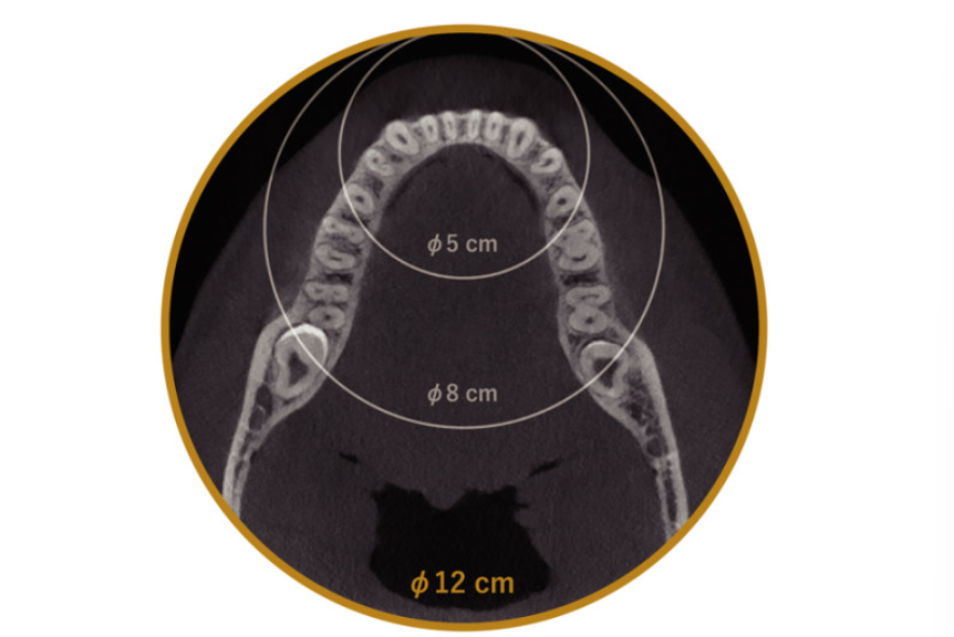 レントゲン画像