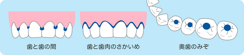 1本1本意識して丁寧に磨きましょう