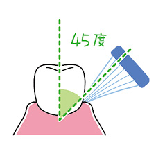 歯と歯肉の境目の磨き方