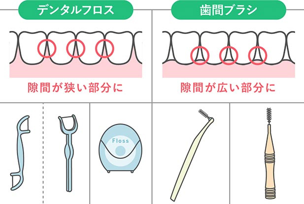 歯と歯の間の磨き方