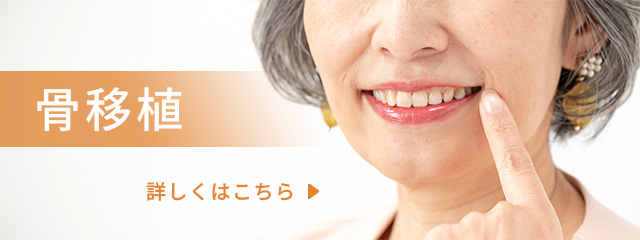 骨移植について詳しくはこちら