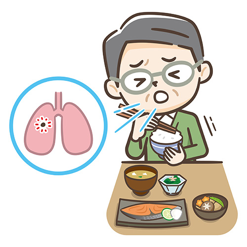 誤嚥イメージ画像