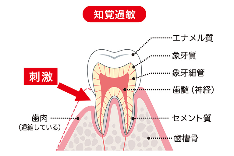 まずは「歯の構造」を理解しよう